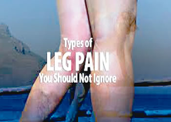 Leg pains that are signs