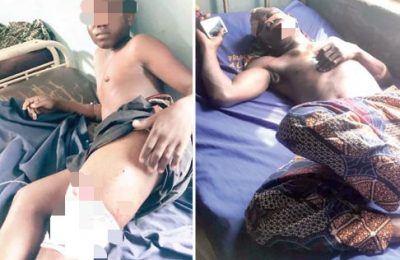 Boy escapes death on father’s bike after erroneous shot by night guard in Ibadan