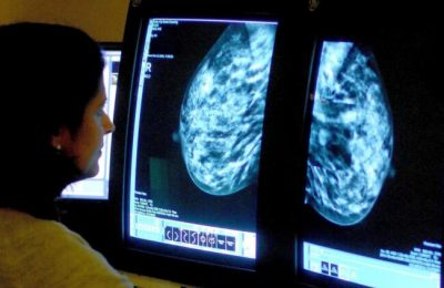 World Cancer Day 2025: 11 key symptoms to watch out for