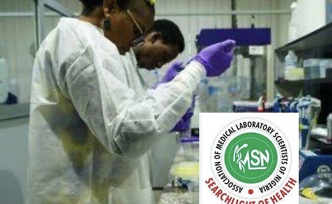 Brain drain: Nigeria lost 906 laboratory scientists in 2022 — AMLSN