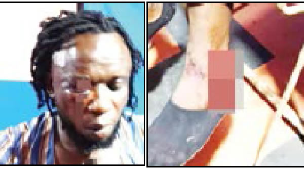 Ebonyi Artiste Allegedly Beaten To Pulp For Refusing To Contine Singing APC Guber Candidate’s Campaign Song