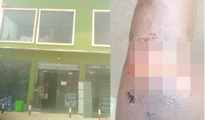 22-Year-Old Man Demands Compensation After OPC Members Allegedly Tortured Him Over Stolen Money In Osun