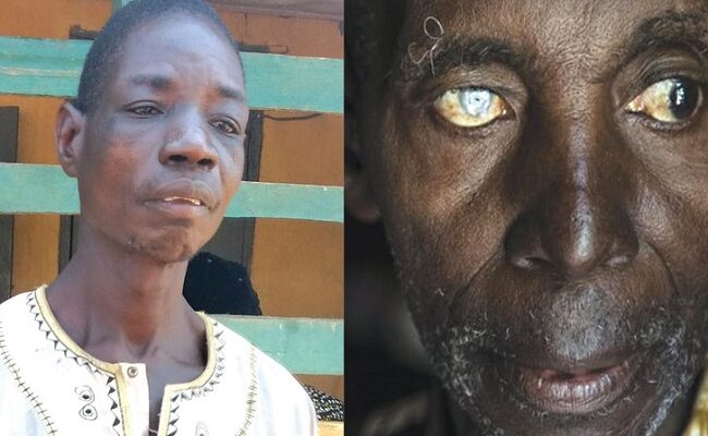 FG achieves criteria to stop river blindness treatment in four states