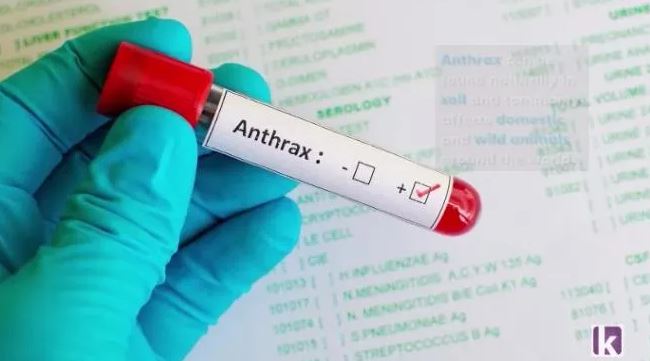 FG Confirms First Case Of Anthrax In Nigeria