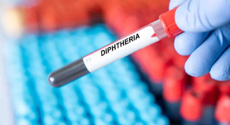 Tackle outbreak of Diphtheria disease, Reps task NCDC, Health Ministry 