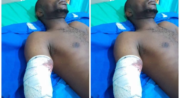 Industrial Machine Cuts Off Worker's Hand In Ogun, Police Begin Probe