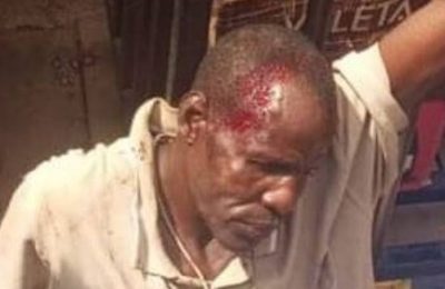 Man caught for stealing manhood beaten to stupor in Kogi
