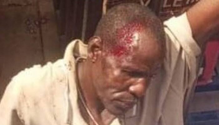 Man caught for stealing manhood beaten to stupor in Kogi