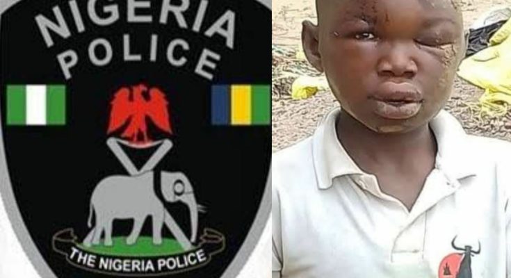 Police arrest 19-year-old boy for burying step-brother alive in Kogi