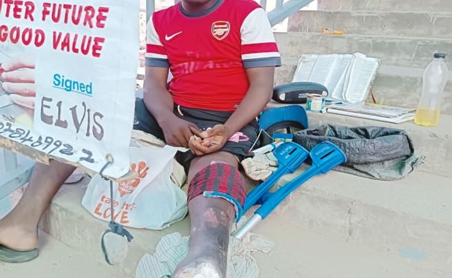 Area boys reopened my wound with belt, stole my N3,200 —Lagos homeless beggar