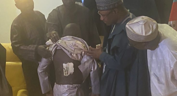 Gov Sani receives 11-year-old boy tortured by Almajiri teacher in Suleja