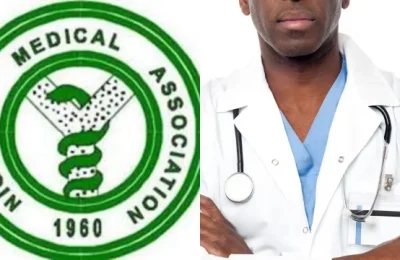 Nigeria to face 50% healthcare workforce loss by 2025 – NMA