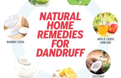 Home remedies for treatment of dandruff 