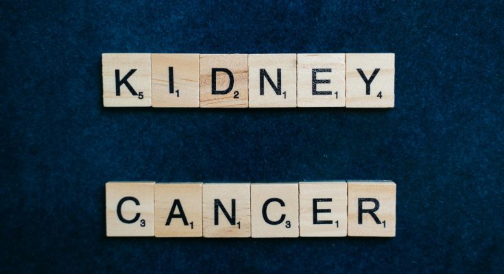 Don't joke with these 7 signs of Kidney Cancer