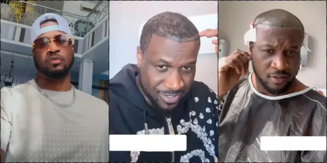 PSquare Peter Okoye undergoes hair transplant to look good for