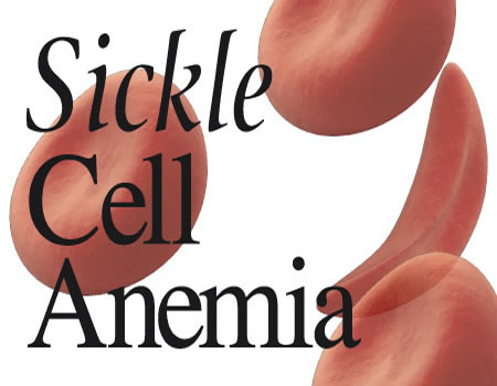 sickle cell, African Sickle Cell Congress