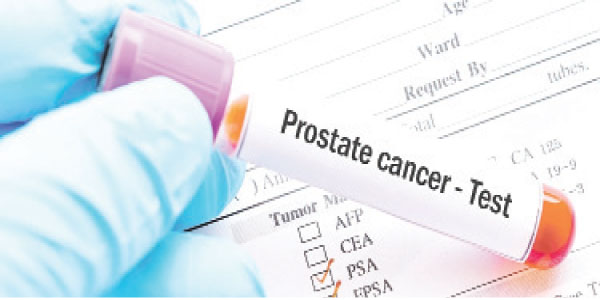 Prostate cancer