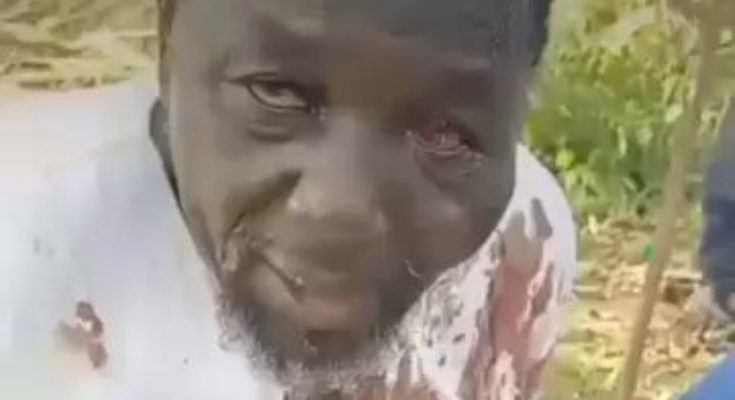 Bandits Release Video Of Abducted Monarch In Blood Stained Cloth