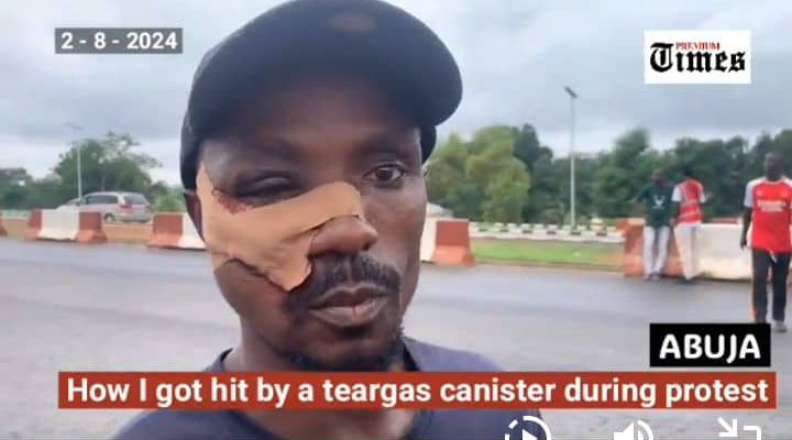 How I got hit by teargas canister — Protester