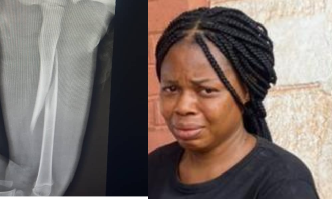 Court Remands Enugu Woman For Allegedly Breaking 3-Years-Old Stepson’s Leg With Pestle