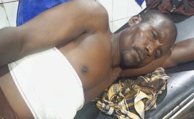 Herbalist injured after shooting self while testing ‘bulletproof’ charm in Abuja